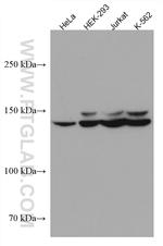 FANCI Antibody in Western Blot (WB)