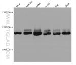 FANCI Antibody in Western Blot (WB)