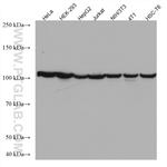 CSE1L Antibody in Western Blot (WB)