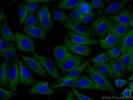 Alpha 2-Antiplasmin Antibody in Immunocytochemistry (ICC/IF)