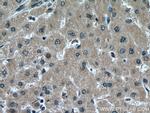 Alpha 2-Antiplasmin Antibody in Immunohistochemistry (Paraffin) (IHC (P))