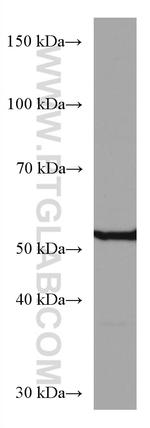 Alpha 2-Antiplasmin Antibody in Western Blot (WB)