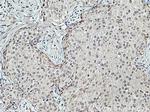 DCPS Antibody in Immunohistochemistry (Paraffin) (IHC (P))