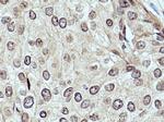 DCPS Antibody in Immunohistochemistry (Paraffin) (IHC (P))