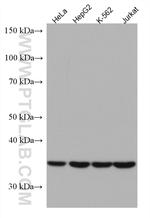 DCPS Antibody in Western Blot (WB)