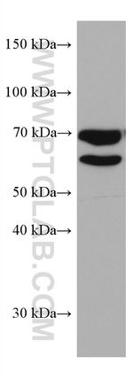 MTMR2 Antibody in Western Blot (WB)