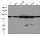 SSRP1 Antibody in Western Blot (WB)
