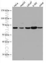 UBP1 Antibody in Western Blot (WB)