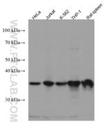 ARPC1B Antibody in Western Blot (WB)