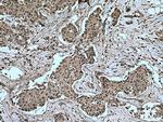 MAP2K4 Antibody in Immunohistochemistry (Paraffin) (IHC (P))