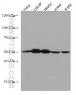 RCC1 Antibody in Western Blot (WB)