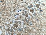 SYNPO Antibody in Immunohistochemistry (Paraffin) (IHC (P))
