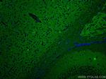 SYNPO Antibody in Immunohistochemistry (PFA fixed) (IHC (PFA))