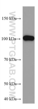 SYNPO Antibody in Western Blot (WB)