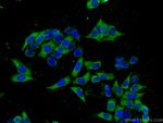 ATG7 Antibody in Immunocytochemistry (ICC/IF)