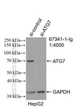 ATG7 Antibody in Western Blot (WB)
