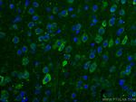 TRIM2 Antibody in Immunohistochemistry (Paraffin) (IHC (P))