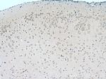 TRIM2 Antibody in Immunohistochemistry (Paraffin) (IHC (P))
