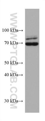 TRIM2 Antibody in Western Blot (WB)