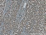 ALDH5A1 Antibody in Immunohistochemistry (Paraffin) (IHC (P))