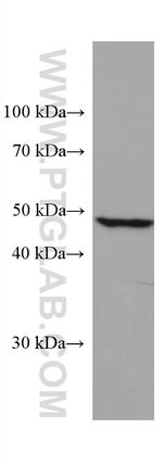 ALDH5A1 Antibody in Western Blot (WB)