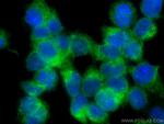 SEC63 Antibody in Immunocytochemistry (ICC/IF)