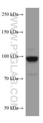 RALBP1 Antibody in Western Blot (WB)