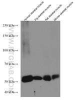 CAPN3 Antibody in Western Blot (WB)