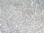PNPLA3 Antibody in Immunohistochemistry (Paraffin) (IHC (P))