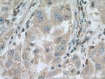 PNPLA3 Antibody in Immunohistochemistry (Paraffin) (IHC (P))