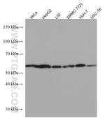 PNPLA3 Antibody in Western Blot (WB)