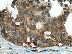 ALDH9A1 Antibody in Immunohistochemistry (Paraffin) (IHC (P))