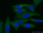 ACC Antibody in Immunocytochemistry (ICC/IF)