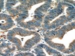 HOMER2 Antibody in Immunohistochemistry (Paraffin) (IHC (P))
