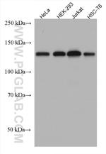 PPP4R1 Antibody in Western Blot (WB)
