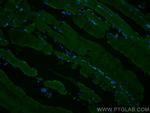 TRIM72 Antibody in Immunohistochemistry (PFA fixed) (IHC (PFA))