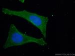 SEC24D Antibody in Immunocytochemistry (ICC/IF)