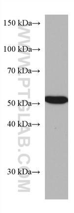 CAP2 Antibody in Western Blot (WB)
