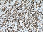 ERO1L Antibody in Immunohistochemistry (Paraffin) (IHC (P))