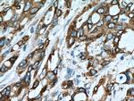 ERO1L Antibody in Immunohistochemistry (Paraffin) (IHC (P))