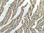 ACVR1 Antibody in Immunohistochemistry (Paraffin) (IHC (P))