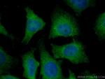 CDCA5 Antibody in Immunocytochemistry (ICC/IF)