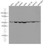 CYP2W1 Antibody in Western Blot (WB)