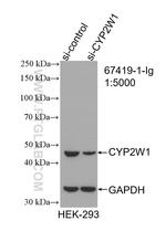CYP2W1 Antibody in Western Blot (WB)
