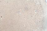 MAP1B Antibody in Immunohistochemistry (Paraffin) (IHC (P))