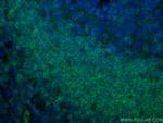 CD72 Antibody in Immunohistochemistry (Paraffin) (IHC (P))