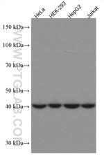 ERP44 Antibody in Western Blot (WB)