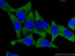 EIF4G2 Antibody in Immunocytochemistry (ICC/IF)