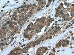 EIF4G2 Antibody in Immunohistochemistry (Paraffin) (IHC (P))