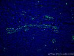 TTPA Antibody in Immunohistochemistry (Paraffin) (IHC (P))
